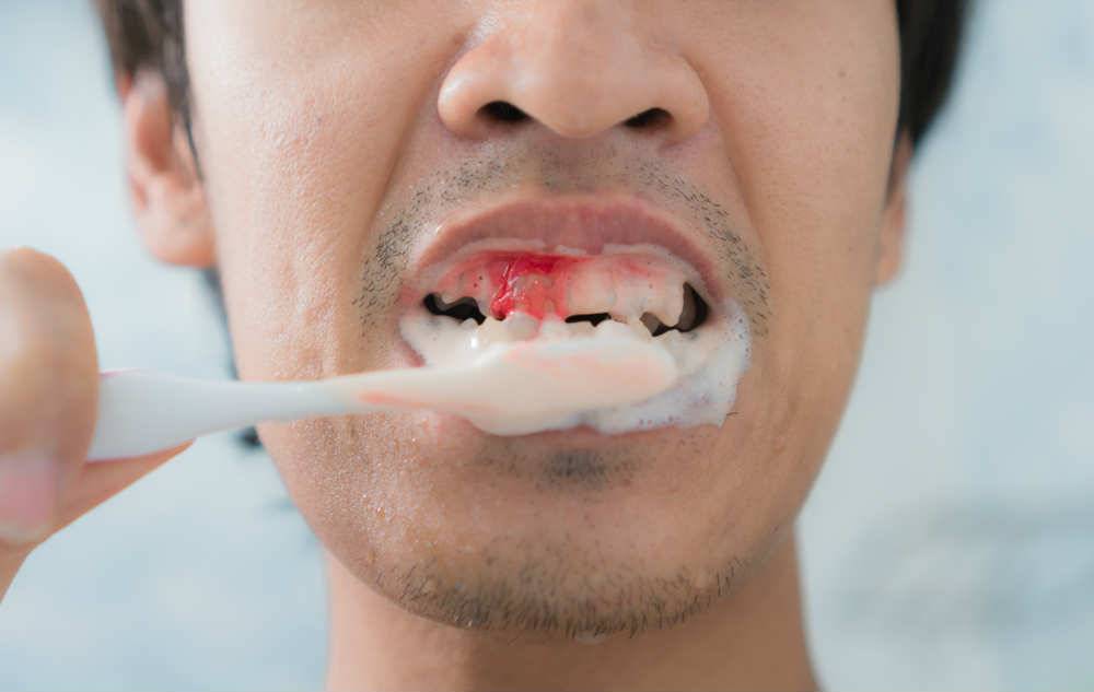 Что делать, если появился запах изо рта после удаления зуба?