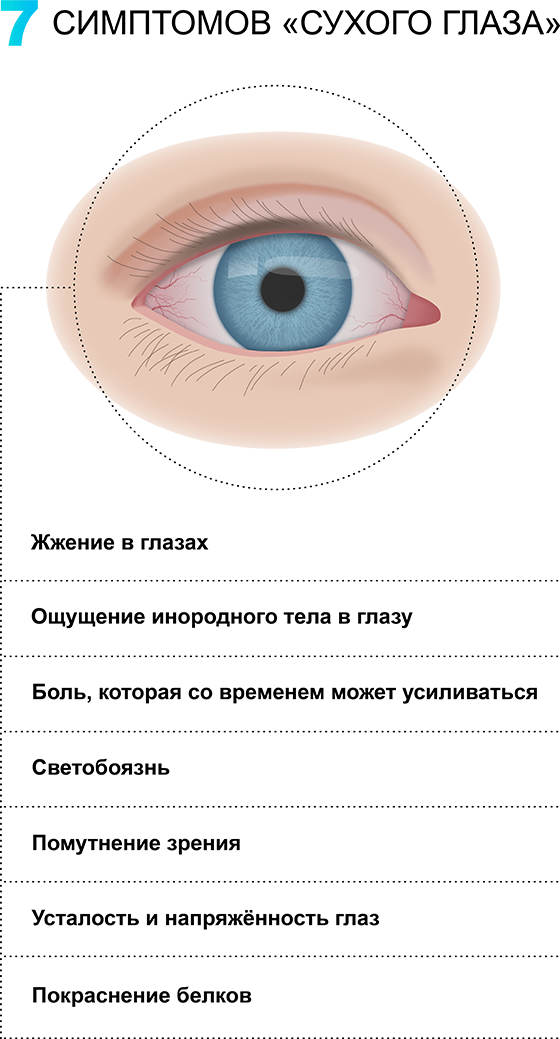 Синдром сухого глаза симптомы. Причины развития синдрома сухого глаза.