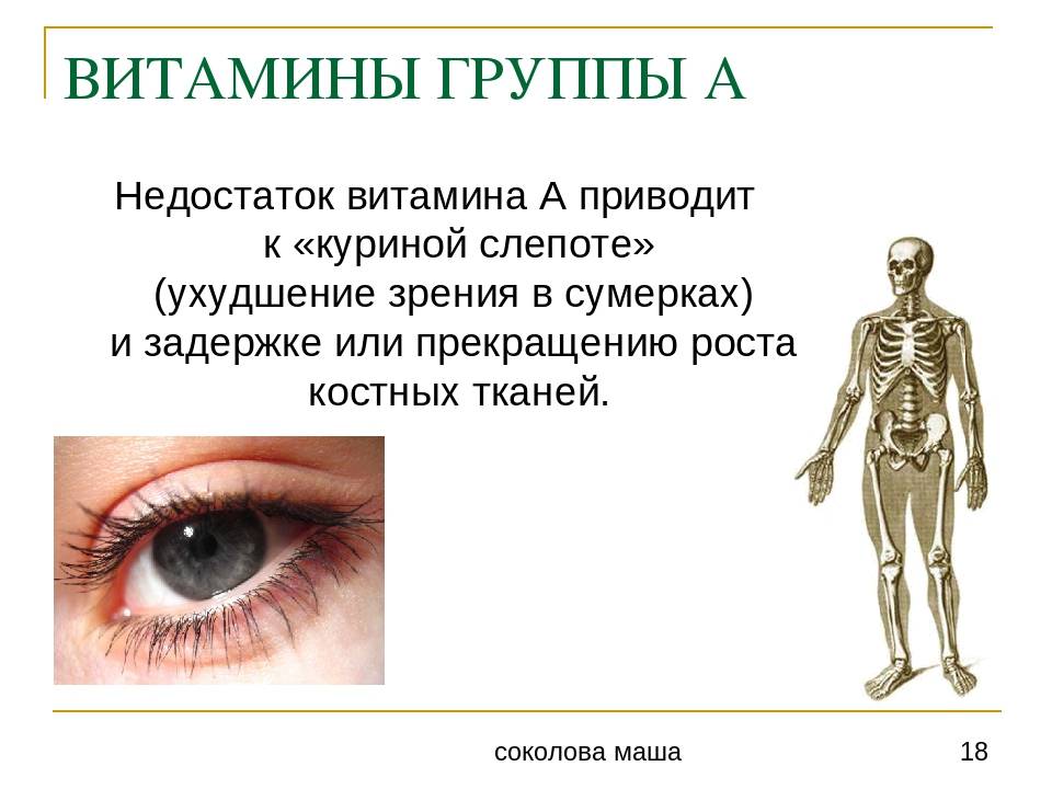Ухудшение зрения в сумерках. Куриная слепота (дефицит витамина а). Недостаток витамина а заболевание. Заболевания при недостатке витамина а.