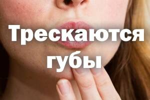 ᐉ почему сильно трескаются губы и болят. какие профилактические меры необходимо проводить? сохнут и трескаются губы - внутренние заболевания ➡ klass511.ru