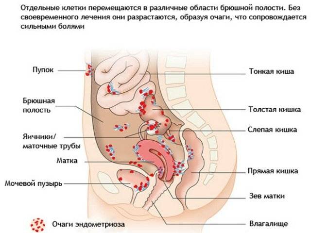 Ноющая боль в пояснице: в спине, справа, слева и внизу возникает из-за заболеваний позвоночника и патологии внутренних органов, причины тупых и сильных болей