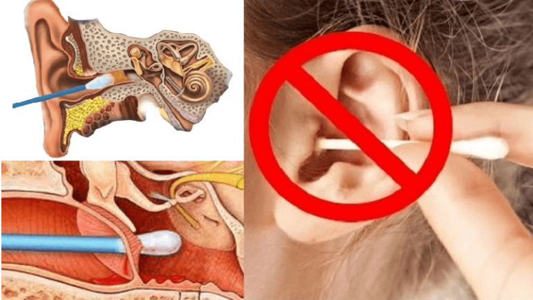 Ухо заложило и болит – чем лечить отит после орви