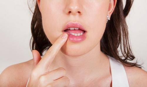Чем лечить герпес на губе дома: мази, таблетки, народные средства