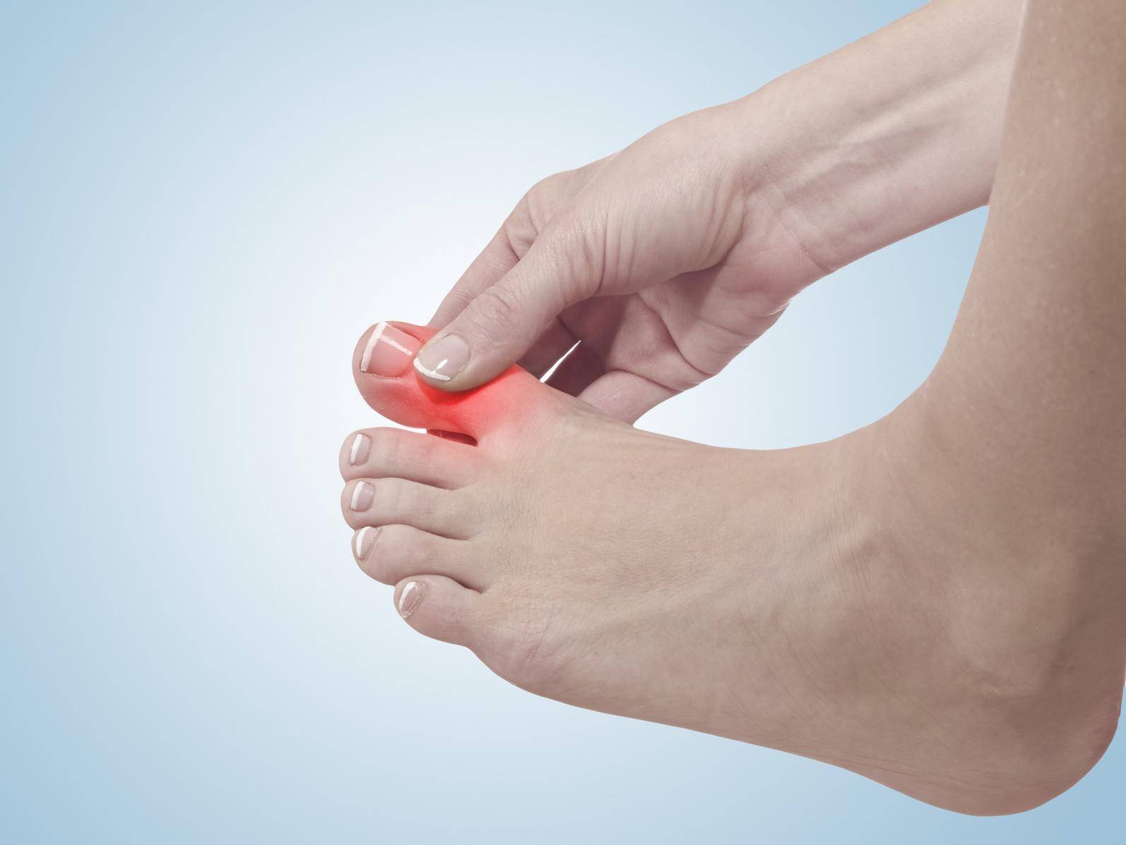 Болит косточка на большом пальце ноги: причины, симптомы, стадии и лечение заболения
