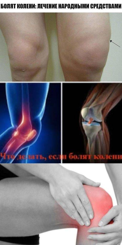 Острая боль в коленном суставе – настигает внезапно, лечится с трудом » здоровые колени