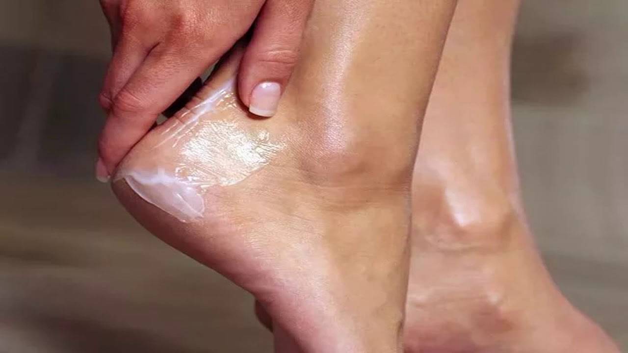 Трещины на стопах ног: причины и методы лечения