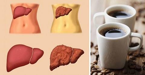 Можно ли пить кофе при гастрите желудка с повышенной или пониженной кислотностью: польза и вред