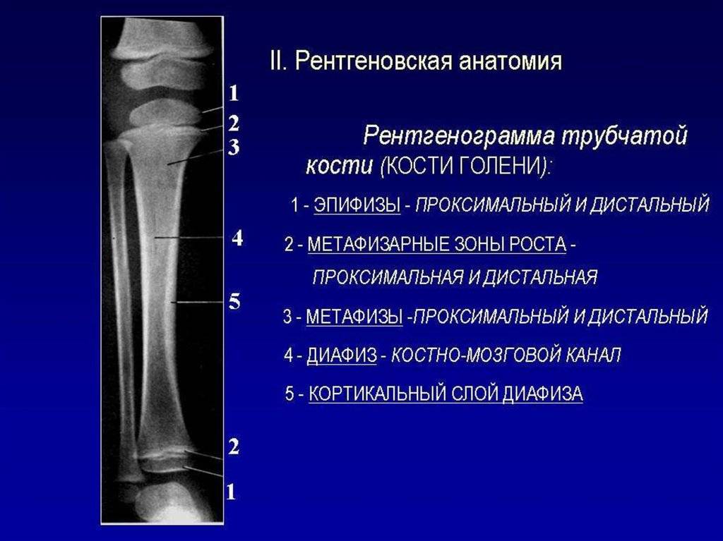 Дистальный лучелоктевой сустав - анатомия - медицинская энциклопедия