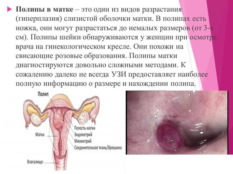 Полип цервикального канала при (во время) беременности: на матке эндометрия, после медикаментозного прерывания на ранних сроках кровит плацентарный участок, опасно или нет, возможно ли и что делать