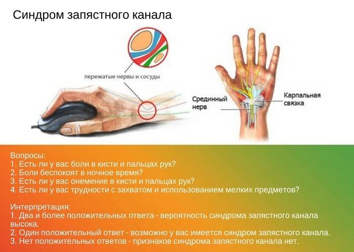 Синдром карпального канала мкб 10. . Кистевой туннельный синдром (карпальный синдром). Карпальный синдром лучезапястного сустава. Туннельный синдром кисти левой руки. Туннельный синдром лучезапястного сустава.