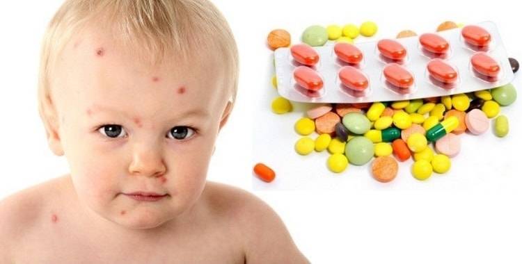 Побочные реакции у детей у детей. Лекарственная аллергия у детей. Аллергия на лекарства у детей. Детская пищевая аллергия.