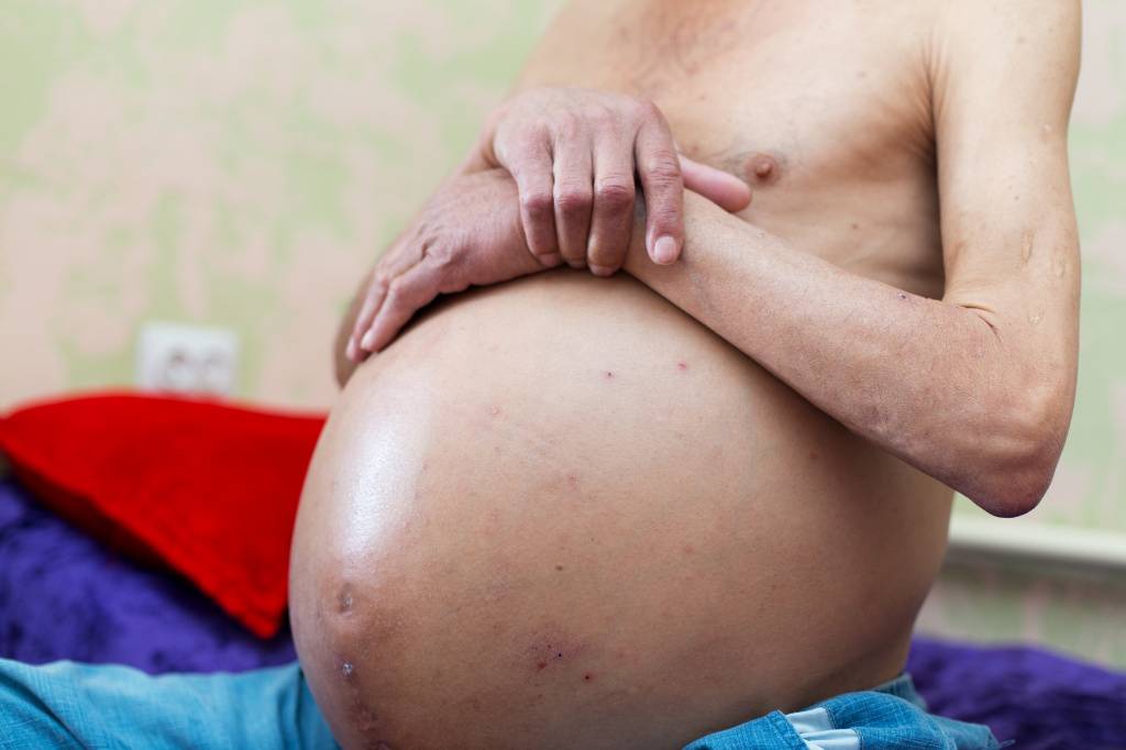 Симптомы коронавируса covid-19 и рассказы выздоровевших   | материнство - беременность, роды, питание, воспитание