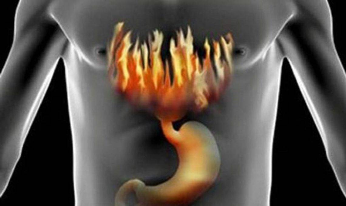 Жжение в желудке, но не изжога - причины и способы лечения