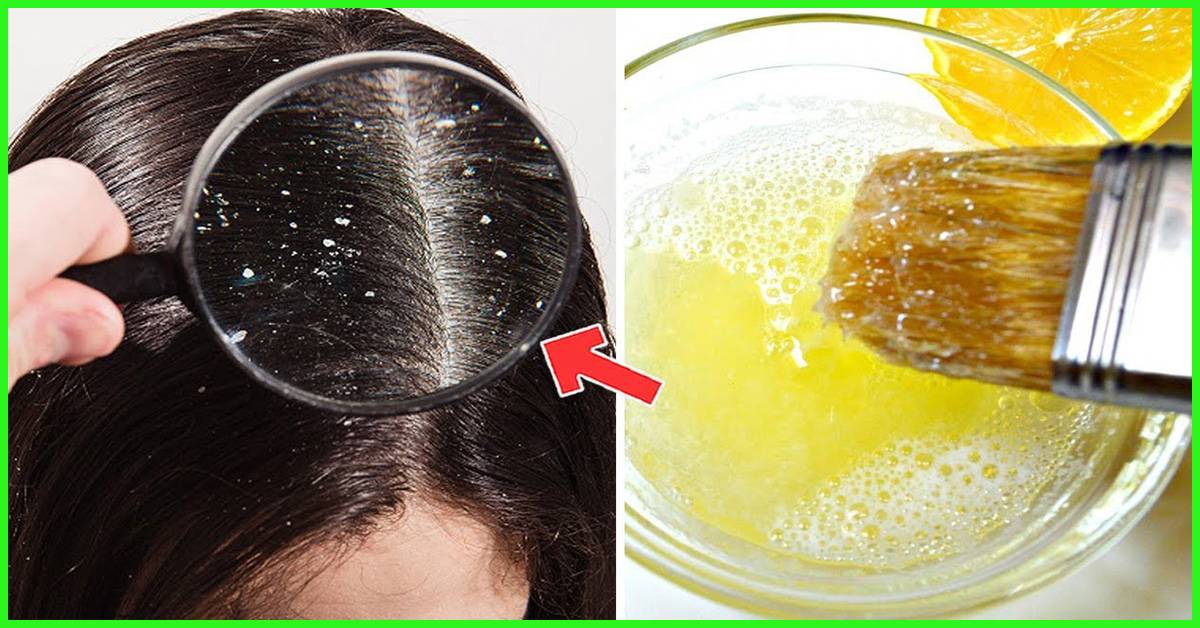 Как избавиться от жирных волос с солью