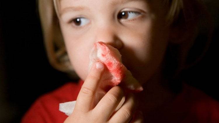 Доктор комаровский о том, почему течет кровь из носа у ребенка