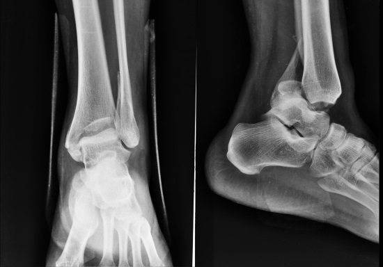 Что показывает рентген суставов, как подготовиться к процедуре и где можно сделать?