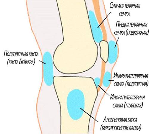 Признаки супрапателлярного бурсита коленного сустава - как помочь своему здоровью