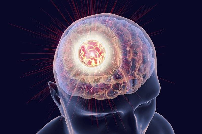 Эффективность лечения при метастазах в головном мозге