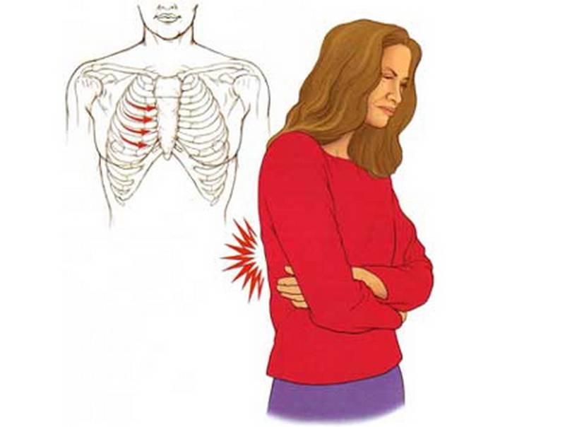 Болит спина отдает в ребра справа. Межреберная невралгия грудной клетки. Межреберная невралгия иррадиация боли. Межреберная невралгия массаж. Межреберная невралгия спины.