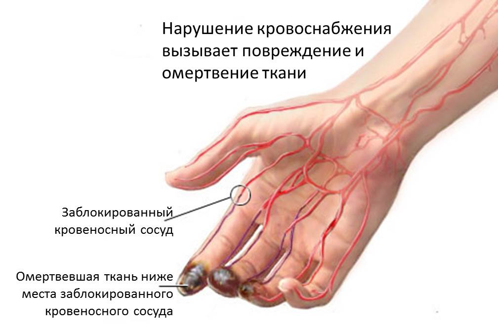 Мёрзнут кончики пальцев на руках и ногах. простое упражнение решит проблему. почему мерзнут пальцы на ногах, руках, немеют. причины и лечение, что это означает. болезни системы кровообращения