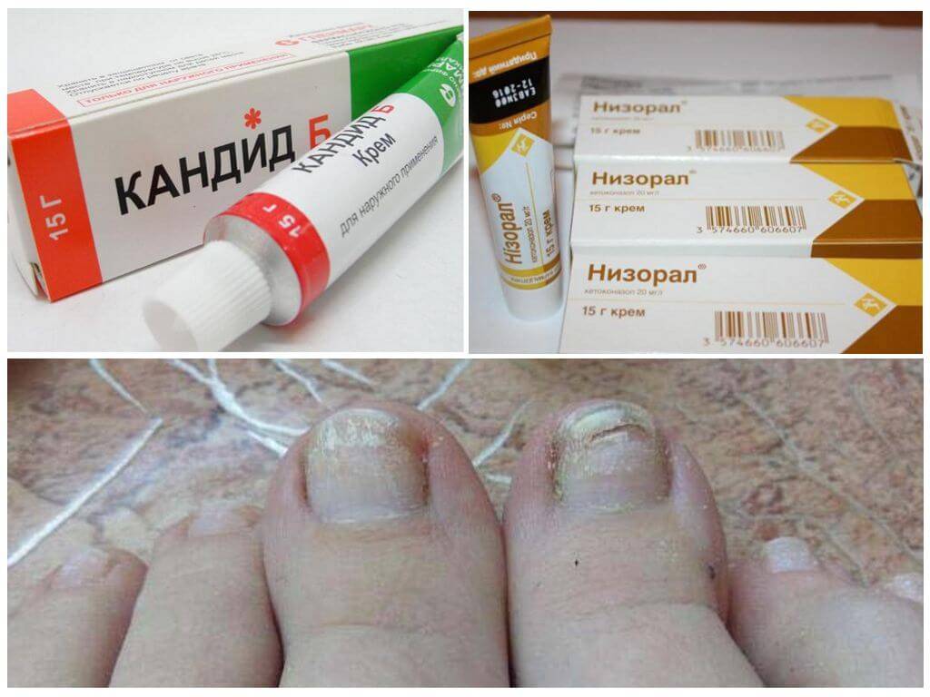 Грибок кожи лечение препараты недорогие но эффективные. Мазь от грибка. Крем от грибка ногтей. Антигрибковый крем для ногтей ног. Мазь от грибка наиногах.