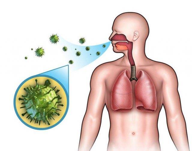 Как лечить стафилококк в горле: лечение золотистого стафилококка