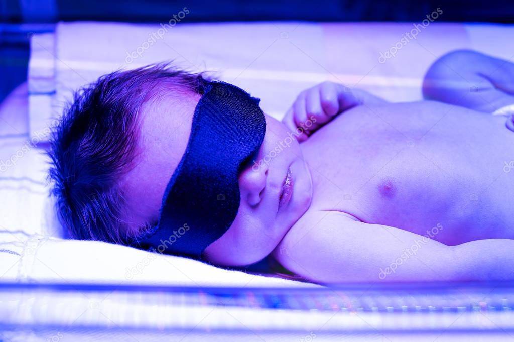 Фототерапия новорожденных при желтухе