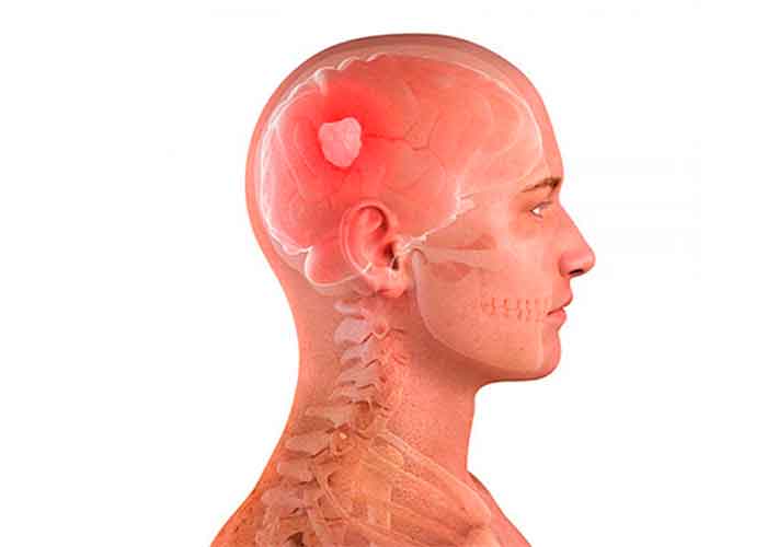 Немеет затылочная часть головы — причины и что делать | здоровье вашей головы