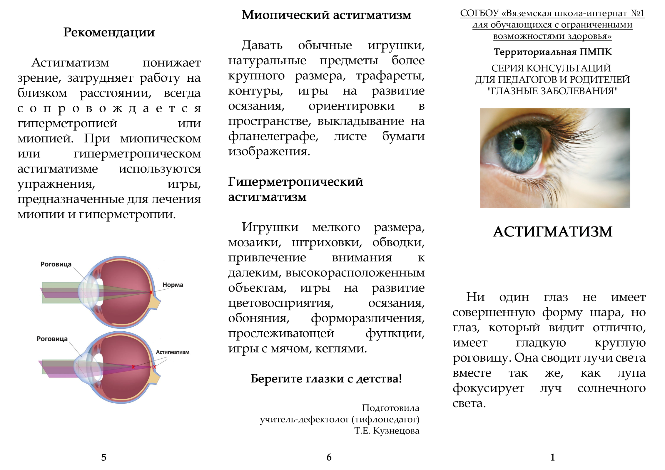 Сложный астигматизм бывает миопическим и гиперметропическим, что это за нарушение рефракции обоих глаз, его лечение и коррекция