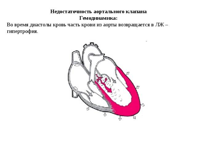 Рабочая классификация приобретённых пороков сердца