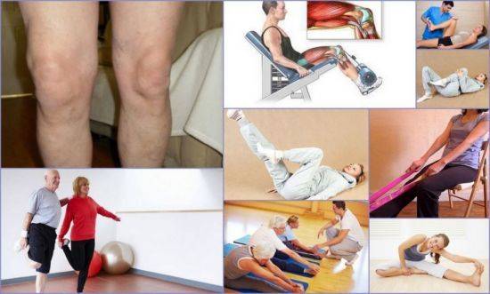 Лечение гонартроза коленного сустава без операции