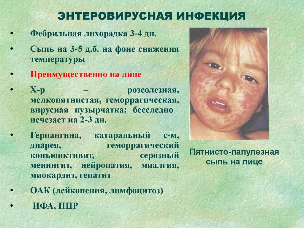 Сыпь при энтеровирусной инфекции у детей: сипмтомы, фото, лечение
