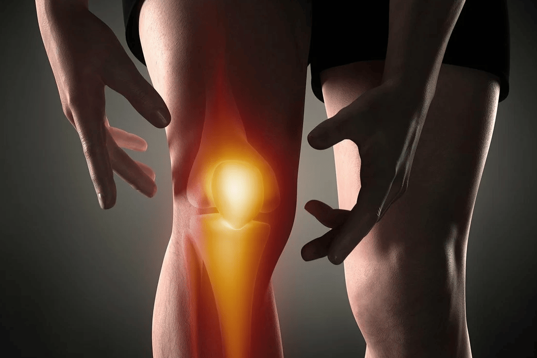 Острая боль в коленном суставе – настигает внезапно, лечится с трудом