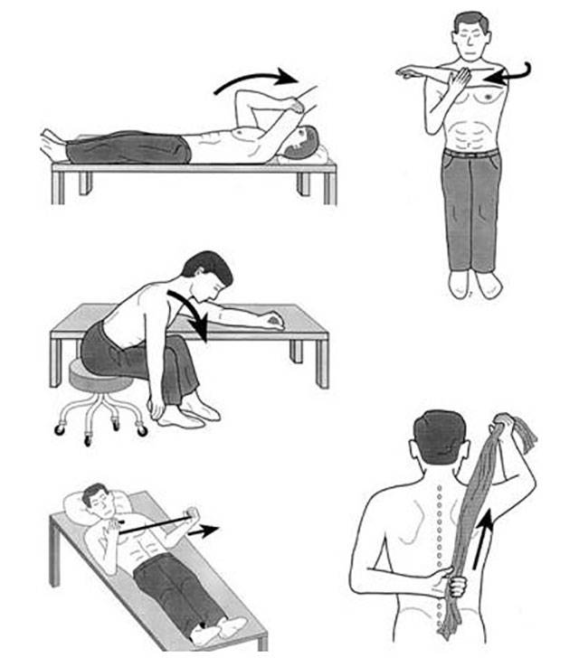 Периартрит плечевого сустава - симптомы, лечение, профилактика