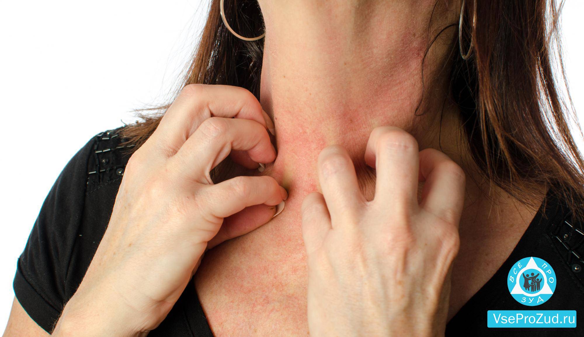 Возможные причины и методы устранения сыпи на лице у женщин