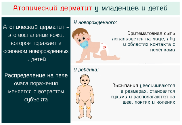 Грибковый пеленочный дерматит у ребенка: фото, симптомы и лечение | fr-dc.ru