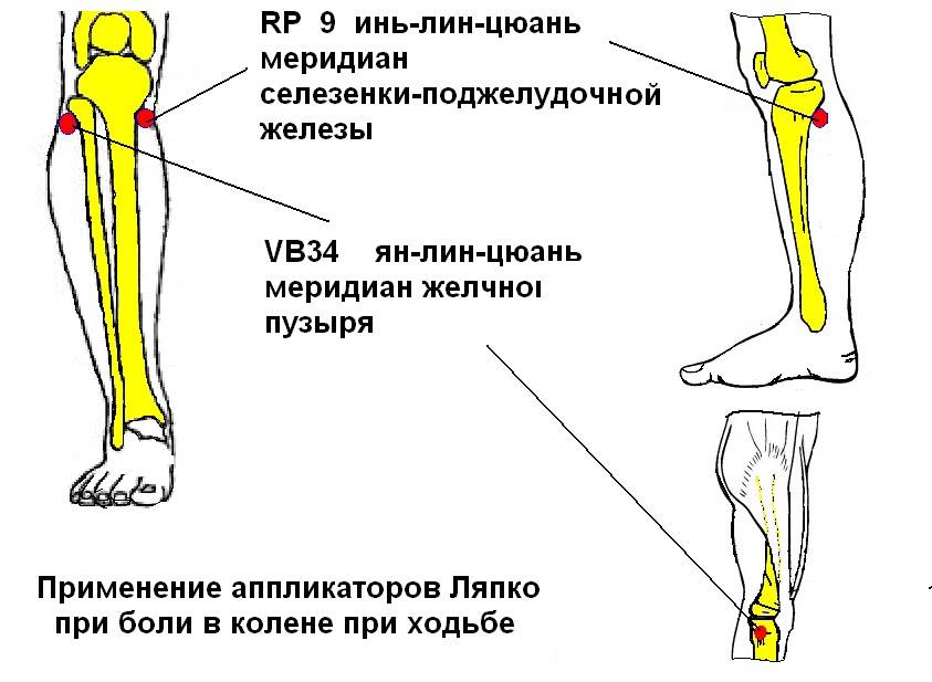 Боль в коленном суставе при ходьбе: причины и лечение