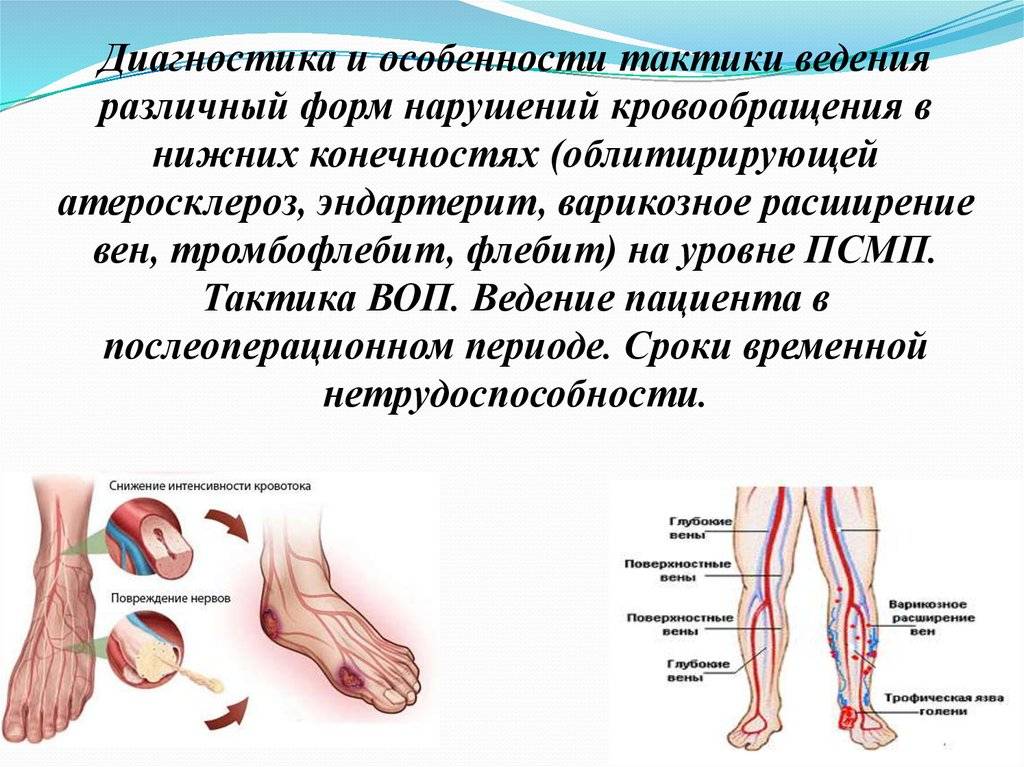 Онемение пальцев ног при сахарном диабете: почему немеют конечности, лечение народными средствами