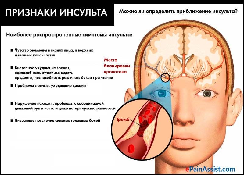 Симптомы предынсультного состояния, признаки поражения отдельных долей мозга, что делать дома и как проходит лечение