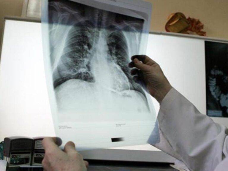 Как часто можно делать рентгеновские снимки и чем опасен рентген