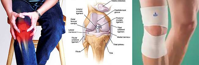Тэп сустава. Внутренняя сторона колена. Чашечка коленного сустава. Боль под коленным суставом. Отечность коленного сустава.