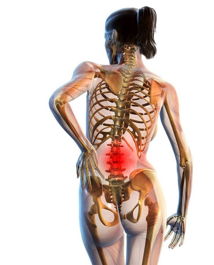 Синдром конского хвоста у человека: симптомы и лечение