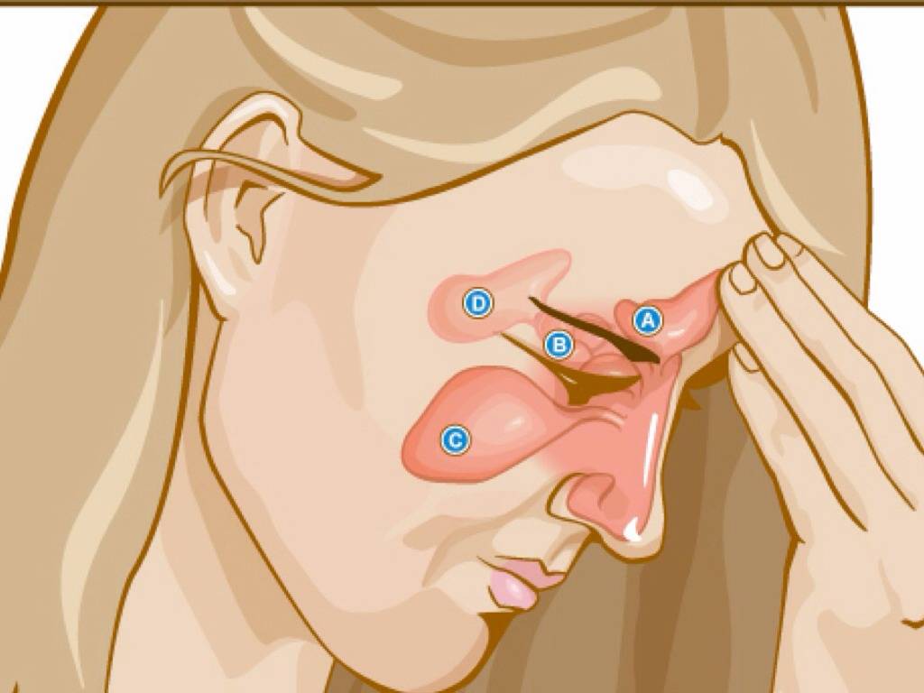 Болячки в носу у ребенка: причины, лечение, виды. лечение гнойных, сухих и мокнущих болячек в носу у детей