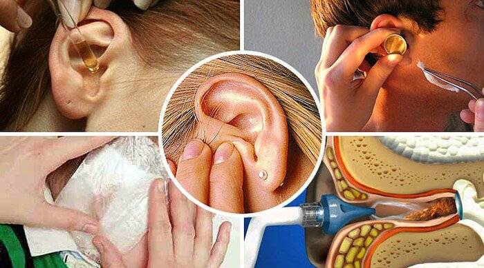 Болит ухо у взрослого: основные причины, вызывающие боль, когда обращаться врачу и как лечить с помощью народной медицины.