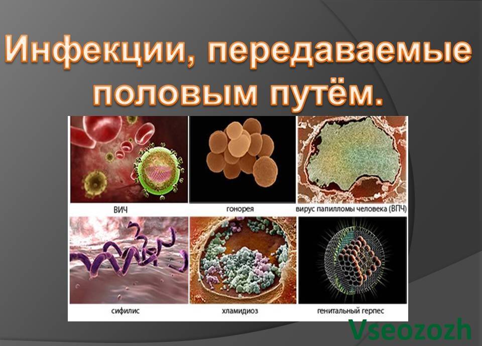 Гонорея презентация по обж