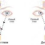 Заболевания глаз (глазные болезни) | все болезни глаз