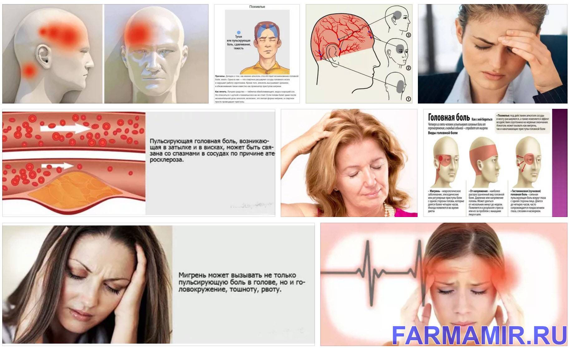 Сильная головная боль в области висков. Пульсирующая головная боль. Причины головной боли. Пульсирующая головная боль в висках. Пульсирует голова и болит.