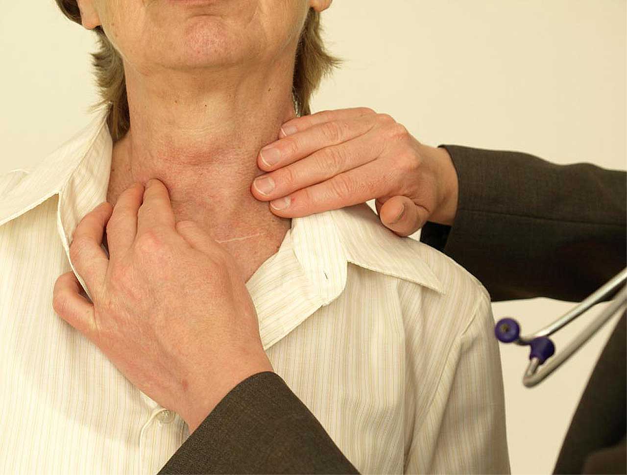 Заболевания щитовидной железы у мужчин