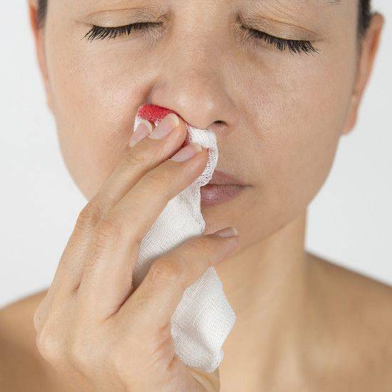 Кровь из носа при насморке: причины, что делать, как остановить