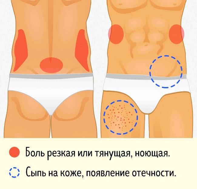 Боль в пояснице справа у женщин: может носить как физиологический, так и патологический характер, причины сильной боли в правой стороне, сзади и внизу